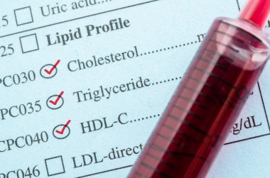 Red mark check on Cholesterol, Triglyceride and HDL-Con request  clipart
