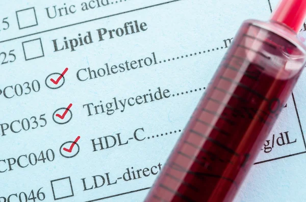 Vörös jellel ellenőrzés, koleszterin-, triglicerid- és Hdl-Con kérésre — Stock Fotó