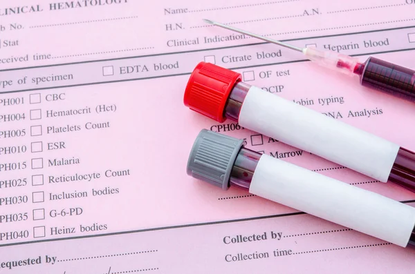 Blood Test Blood Samples On A Laboratory Form Stock Photo By C Fotoquique