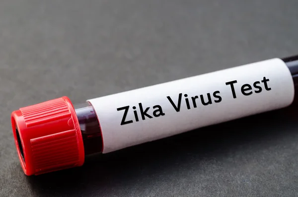 Concepto de prueba del virus Zika . — Foto de Stock