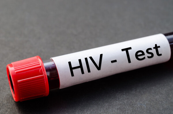 Sample blood collection tube with HIV test.