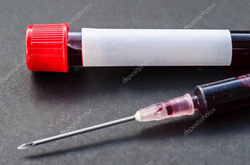 Blood sample in tube and syringe. Stock Photo by ©gamjai 111884240