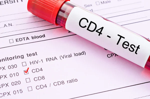 Cd4 hücre testi.