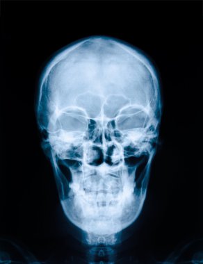 X-ray picture of skull clipart