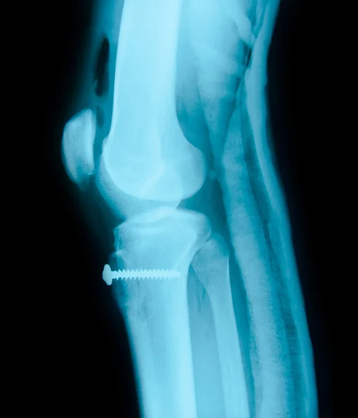 Articulación de rodilla derecha y equipo médico Rayos X — Foto de Stock