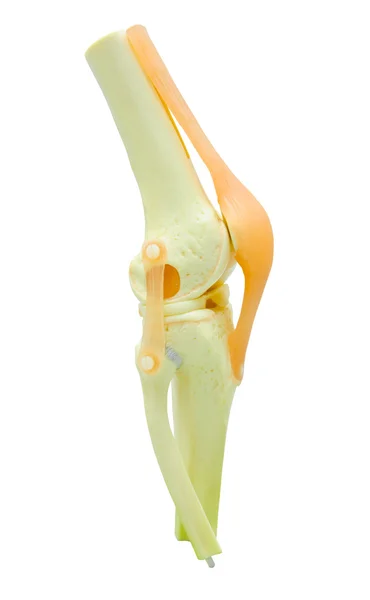 Modelo de estudio plástico de un reemplazo de rodilla . —  Fotos de Stock