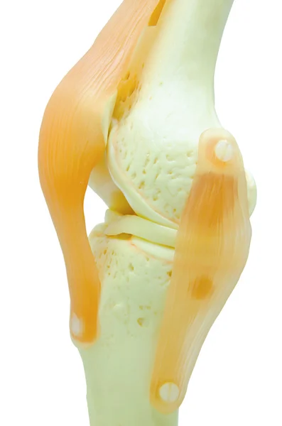 Kunststof studie model van een knie-vervanging. — Stockfoto