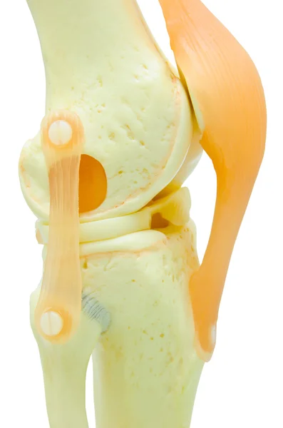 膝関節置換術のプラスチック モデル. — ストック写真