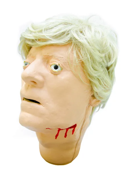 Modelo de pacientes com lesão na cabeça . — Fotografia de Stock