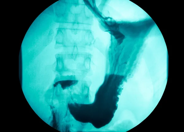 Radiographie abdominale intestinale — Photo