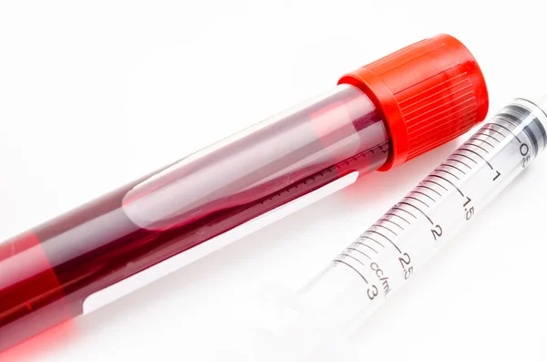 Blood sample in tube blood for screening test — Stock Photo, Image