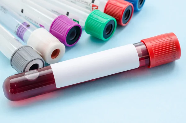 Blood samples tube for screening test. — Stock Photo, Image