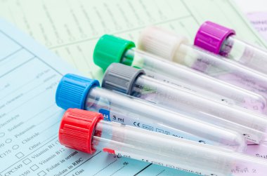 Birçok tüp blod kan testi filtreleme için boş 
