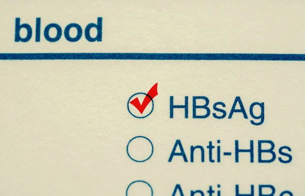 Häkchen beim Hepatitis-B-Virus-Test. — Stockfoto