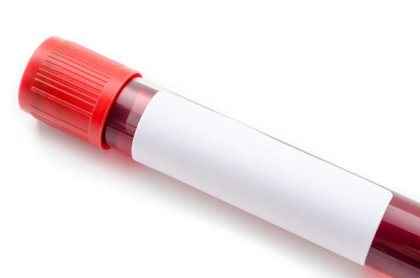 Etiqueta de papel en blanco en Tubo sanguíneo para análisis —  Fotos de Stock