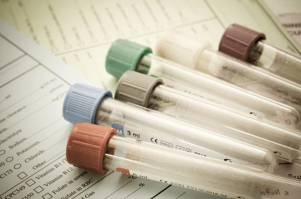 The old blood tubes for test on reqest form medical testing — Stock Photo, Image