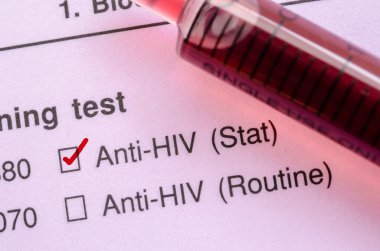 Kırmızı doğru onay işareti ile kan örneği HIV testi.