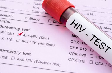 Örnek kan toplama tüp HIV testi etiketi.
