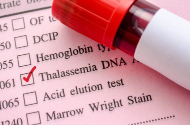 Kan tüpü talasemi Dna için örnek kan testi.