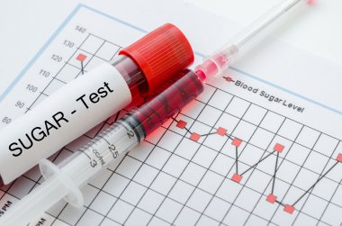 Tarama diyabetik testi için örnek kan.
