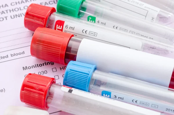 Blood sample test and empty tube blood for blood test screening. — Stock Photo, Image