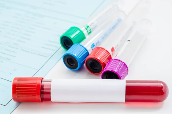 Blood sample test and empty tube blood for blood test. — Stock Photo, Image