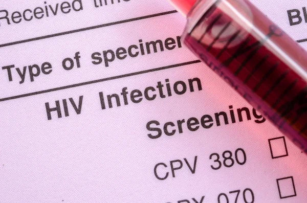 HIV-infektion screening test form. — Stockfoto