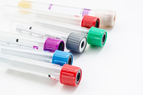 Tubos de vácuo para a coleta de amostras de sangue no laboratório. — Fotografia de Stock