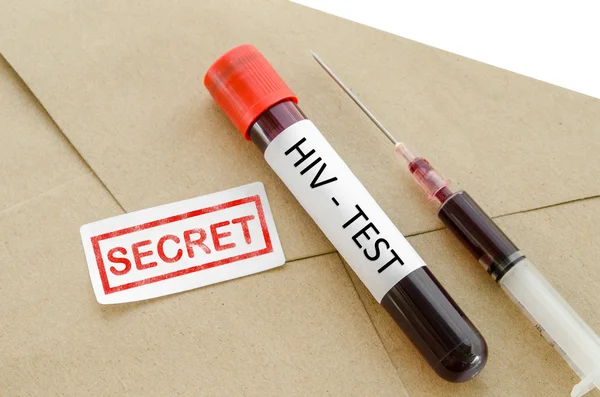 Diagnostic secret du résultat Concept de test VIH . — Photo