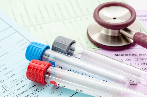 Stethoskopröhrchen mit Blut und medizinische Checkliste — Stockfoto