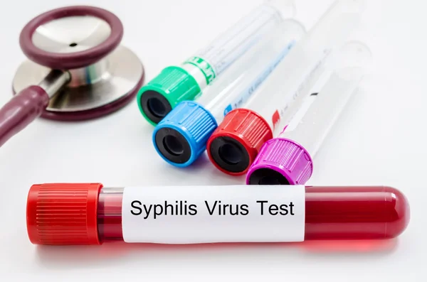 Syfilis virus blod prov insamling tube. Stockbild