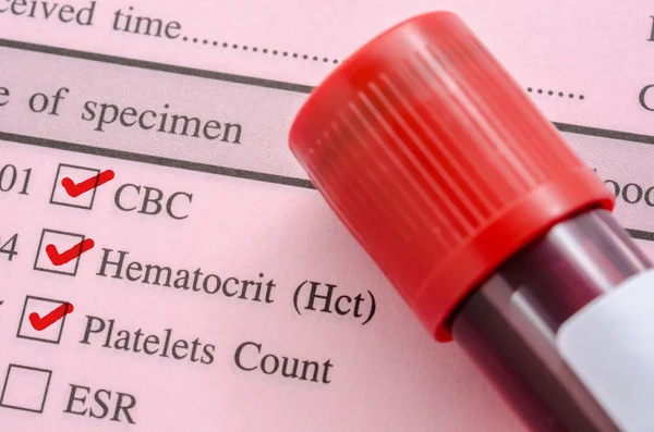 Cbc, hemotocrit, Thrombozytenzahl mit Anfrage Screening-Test — Stockfoto