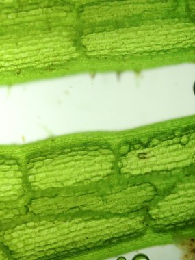 Yakınlaştırma mikroorganizma yosun