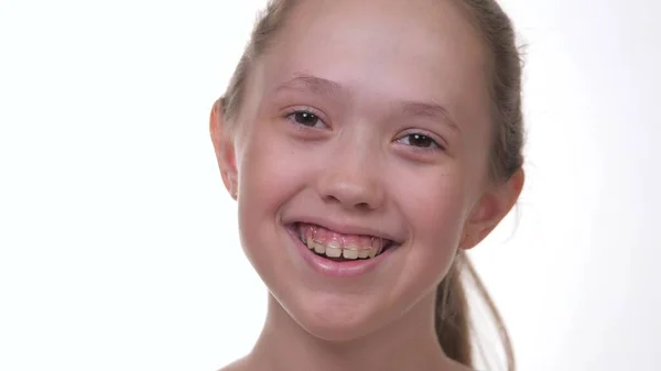 Niña feliz sonriendo con dientes sobre fondo blanco aislado. Morder placa de corrección y los dientes torcidos. El niño hace una corrección de sonrisa en la odontología en el ortodoncista. Indicaciones para el —  Fotos de Stock