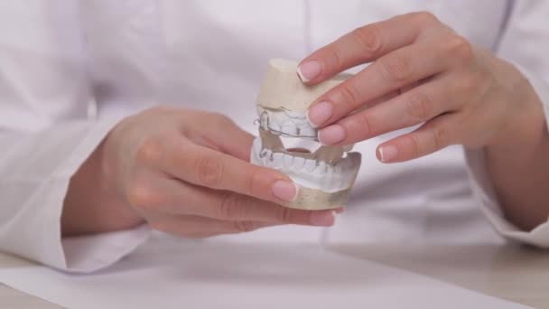 Een vrouwelijke orthodontist houdt een bord in haar hand voor het corrigeren van tanden en occlusie. Om de plaat op de witte tanden te plakken. Een kaakbehandeling in een gespecialiseerd dokterskantoor. Een gezond en mooi — Stockvideo