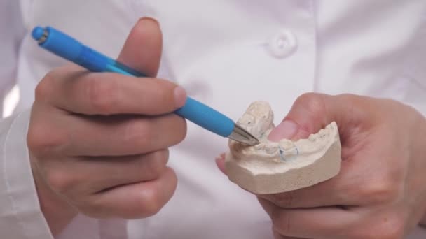 牙齿矫正师手中用石膏制成的白牙。在牙科医院做一个美丽而健康的微笑。纠正儿童咬人的行为。牙医商业专家。维生素钙 — 图库视频影像