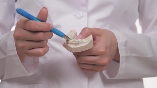 Witte tanden gemaakt van gips in de handen van een orthodontist. Maak een mooie en gezonde glimlach in het tandheelkundig ziekenhuis. Correctie van de beet van kinderen. Tandartsspecialist. Calciumvitamine — Stockvideo