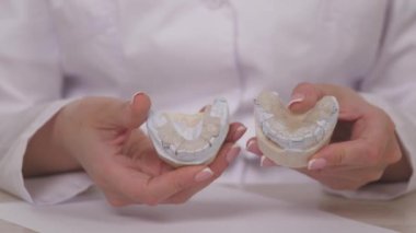 Bir kadın ortodontist elinde diş düzeltme ve tıkanıklığı için bir tabak tutuyor. Plastik beyaz dişlere plaka takmak için. Uzman bir doktorun ofisinde çene tedavisi. Sağlıklı ve güzel