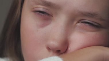 Genç bir kız ağlıyor ve gözyaşları yanaklarından akıyor. Çocuk vücuttaki hormonal değişimlerden dolayı üzgün. Akranları ve aileleriyle yaşadığı sorunlardan dolayı çocuklar gergin. Yaşam tarzı ruh ağlaması. Korku ve