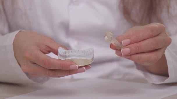 Uma mulher ortodontista segura na mão uma placa para correção dos dentes e oclusão. Para colocar a placa sobre os dentes brancos de gesso. Tratamento da mandíbula em um consultório médico especializado. Um saudável e bonito — Vídeo de Stock