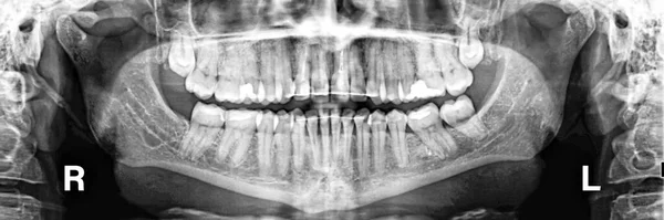 Raio Panorâmico Dentes Humanos Exame Tratamento Cuidados Dentários Banner — Fotografia de Stock