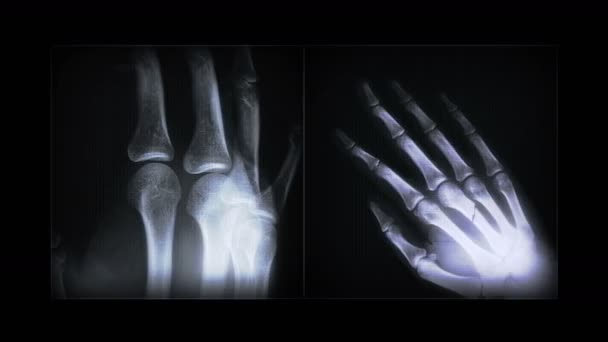 Imágenes de rayos X abstracto 4k — Vídeo de stock