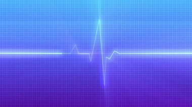 EKG monitörünün grafiği