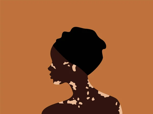 Vista Lateral Mulher Africana Turbante Com Vitiligo Fundo Laranja Conceito —  Vetores de Stock