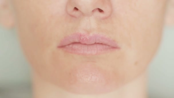 Meisje zweertjes op de lippen aan te raken. herpes. lip behandeling — Stockvideo