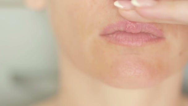 Chica tocando llagas en los labios. herpes. tratamiento labial — Vídeo de stock