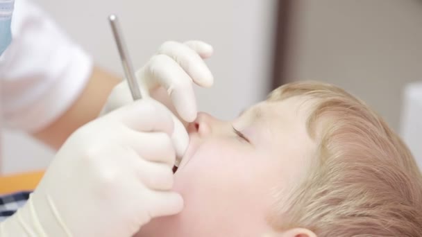 Niño pequeño durante la inspección de la cavidad oral. dentista — Vídeos de Stock