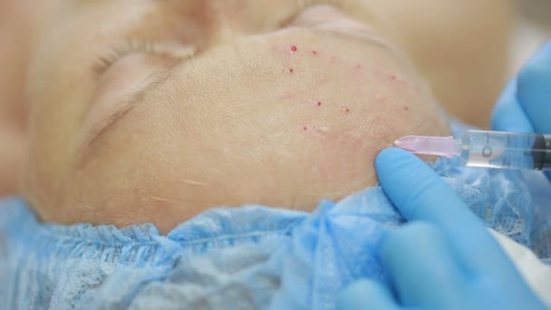 Cosmetische behandeling met een injectie in een kliniek. verrijking van de huid — Stockvideo