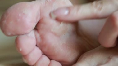 kadın ayakları ile cilt soyulmuştu. işlemden sonra fırçalayın ayak