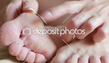 kadın ayakları ile cilt soyulmuştu. işlemden sonra fırçalayın ayak